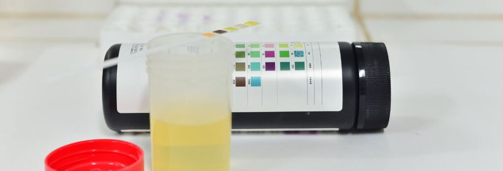 Dog urine test strip.